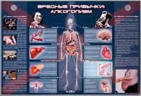 Электрифицированный стенд "Вредные привычки: алкоголизм" - «globural.ru» - Санкт-Петербург