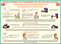 Таблица Порядок действий при опасном кровотечении 1000*1400 винил - «globural.ru» - Санкт-Петербург