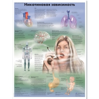 Плакат "Никотиновая зависимость", ламинированный, 50*67 см - «globural.ru» - Санкт-Петербург